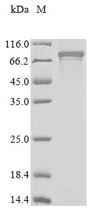 Recombinant Human Protein CBFA2T1 (RUNX1T1) - image 1