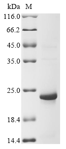(Tris-Glycine gel) Discontinuous SDS-PAGE (reduced) with 5% enrichment gel and 15% separation gel. (Tris-Glycine gel) Discontinuous SDS-PAGE (reduced) with 5% enrichment gel and 15% separation gel.