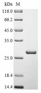(Tris-Glycine gel) Discontinuous SDS-PAGE (reduced) with 5% enrichment gel and 15% separation gel. (Tris-Glycine gel) Discontinuous SDS-PAGE (reduced) with 5% enrichment gel and 15% separation gel.