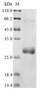 Recombinant Mouse Protein PML (Pml) , partial - image 1