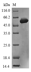 (Tris-Glycine gel) Discontinuous SDS-PAGE (reduced) with 5% enrichment gel and 15% separation gel. (Tris-Glycine gel) Discontinuous SDS-PAGE (reduced) with 5% enrichment gel and 15% separation gel.