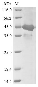 (Tris-Glycine gel) Discontinuous SDS-PAGE (reduced) with 5% enrichment gel and 15% separation gel. (Tris-Glycine gel) Discontinuous SDS-PAGE (reduced) with 5% enrichment gel and 15% separation gel.