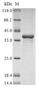 Recombinant Bovine Nucleotide-binding oligomerization domain-containing protein 2 (NOD2) , partial - image 1