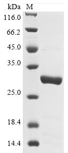 Recombinant Pongo abelII Lysosome-associated membrane glycoprotein 5 (LAMP5) , partial - image 1