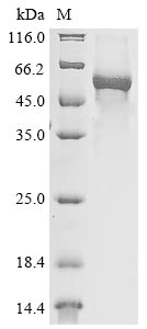 (Tris-Glycine gel) Discontinuous SDS-PAGE (reduced) with 5% enrichment gel and 15% separation gel. (Tris-Glycine gel) Discontinuous SDS-PAGE (reduced) with 5% enrichment gel and 15% separation gel.