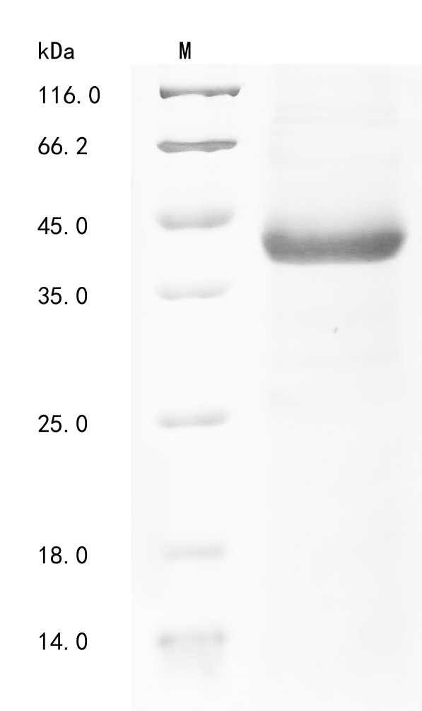 (Tris-Glycine gel) Discontinuous SDS-PAGE (reduced) with 5% enrichment gel and 15% separation gel.