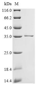 Recombinant Human Protein GPR107 (GPR107) , partial - image 1