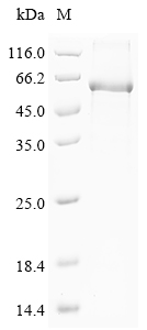 (Tris-Glycine gel) Discontinuous SDS-PAGE (reduced) with 5% enrichment gel and 15% separation gel. (Tris-Glycine gel) Discontinuous SDS-PAGE (reduced) with 5% enrichment gel and 15% separation gel.