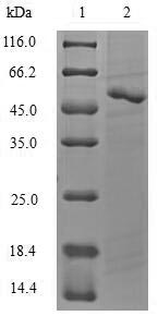 (Tris-Glycine gel) Discontinuous SDS-PAGE (reduced) with 5% enrichment gel and 15% separation gel.
