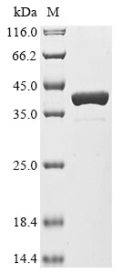 Recombinant Photobacterium profundum ATP synthase gamma chain 2 (atpG2) - image 1