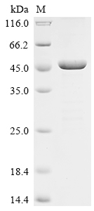(Tris-Glycine gel) Discontinuous SDS-PAGE (reduced) with 5% enrichment gel and 15% separation gel.
