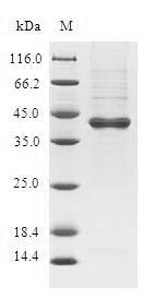 (Tris-Glycine gel) Discontinuous SDS-PAGE (reduced) with 5% enrichment gel and 15% separation gel. (Tris-Glycine gel) Discontinuous SDS-PAGE (reduced) with 5% enrichment gel and 15% separation gel.
