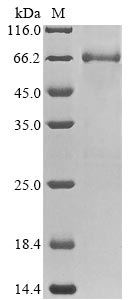 (Tris-Glycine gel) Discontinuous SDS-PAGE (reduced) with 5% enrichment gel and 15% separation gel. (Tris-Glycine gel) Discontinuous SDS-PAGE (reduced) with 5% enrichment gel and 15% separation gel.