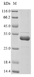 (Tris-Glycine gel) Discontinuous SDS-PAGE (reduced) with 5% enrichment gel and 15% separation gel.