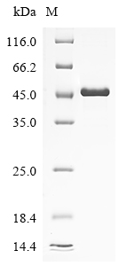(Tris-Glycine gel) Discontinuous SDS-PAGE (reduced) with 5% enrichment gel and 15% separation gel. (Tris-Glycine gel) Discontinuous SDS-PAGE (reduced) with 5% enrichment gel and 15% separation gel.