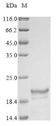 (Tris-Glycine gel) Discontinuous SDS-PAGE (reduced) with 5% enrichment gel and 15% separation gel. (Tris-Glycine gel) Discontinuous SDS-PAGE (reduced) with 5% enrichment gel and 15% separation gel.
