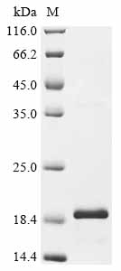 (Tris-Glycine gel) Discontinuous SDS-PAGE (reduced) with 5% enrichment gel and 15% separation gel. (Tris-Glycine gel) Discontinuous SDS-PAGE (reduced) with 5% enrichment gel and 15% separation gel.