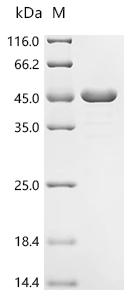 Recombinant Mycobacterium tuberculosis Transporter PPE51 (PPE51) - image 1