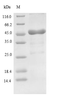 (Tris-Glycine gel) Discontinuous SDS-PAGE (reduced) with 5% enrichment gel and 15% separation gel.