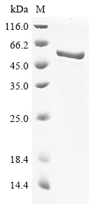 (Tris-Glycine gel) Discontinuous SDS-PAGE (reduced) with 5% enrichment gel and 15% separation gel. (Tris-Glycine gel) Discontinuous SDS-PAGE (reduced) with 5% enrichment gel and 15% separation gel.