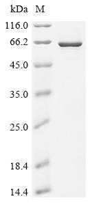Recombinant Human Bifunctional arginine demethylase and lysyl-hydroxylase JMJD6 (JMJD6) - image 1