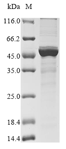 Recombinant Human metapneumovirus Nucleoprotein (N) - image 1
