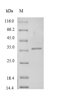 (Tris-Glycine gel) Discontinuous SDS-PAGE (reduced) with 5% enrichment gel and 15% separation gel. (Tris-Glycine gel) Discontinuous SDS-PAGE (reduced) with 5% enrichment gel and 15% separation gel.