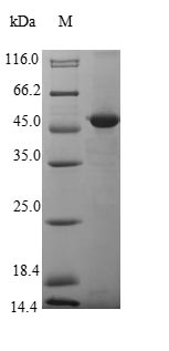 (Tris-Glycine gel) Discontinuous SDS-PAGE (reduced) with 5% enrichment gel and 15% separation gel. (Tris-Glycine gel) Discontinuous SDS-PAGE (reduced) with 5% enrichment gel and 15% separation gel.