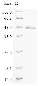 (Tris-Glycine gel) Discontinuous SDS-PAGE (reduced) with 5% enrichment gel and 15% separation gel.