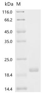 (Tris-Glycine gel) Discontinuous SDS-PAGE (reduced) with 5% enrichment gel and 15% separation gel. (Tris-Glycine gel) Discontinuous SDS-PAGE (reduced) with 5% enrichment gel and 15% separation gel.
