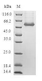(Tris-Glycine gel) Discontinuous SDS-PAGE (reduced) with 5% enrichment gel and 15% separation gel. (Tris-Glycine gel) Discontinuous SDS-PAGE (reduced) with 5% enrichment gel and 15% separation gel.