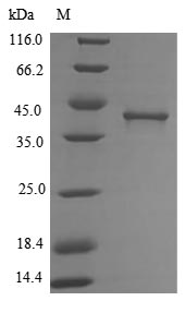 (Tris-Glycine gel) Discontinuous SDS-PAGE (reduced) with 5% enrichment gel and 15% separation gel. (Tris-Glycine gel) Discontinuous SDS-PAGE (reduced) with 5% enrichment gel and 15% separation gel.