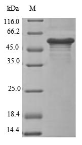(Tris-Glycine gel) Discontinuous SDS-PAGE (reduced) with 5% enrichment gel and 15% separation gel. (Tris-Glycine gel) Discontinuous SDS-PAGE (reduced) with 5% enrichment gel and 15% separation gel.