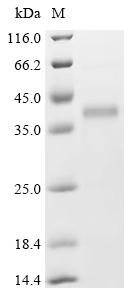 (Tris-Glycine gel) Discontinuous SDS-PAGE (reduced) with 5% enrichment gel and 15% separation gel.