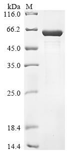 (Tris-Glycine gel) Discontinuous SDS-PAGE (reduced) with 5% enrichment gel and 15% separation gel. (Tris-Glycine gel) Discontinuous SDS-PAGE (reduced) with 5% enrichment gel and 15% separation gel.