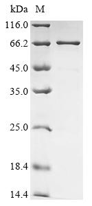 (Tris-Glycine gel) Discontinuous SDS-PAGE (reduced) with 5% enrichment gel and 15% separation gel. (Tris-Glycine gel) Discontinuous SDS-PAGE (reduced) with 5% enrichment gel and 15% separation gel.