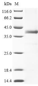(Tris-Glycine gel) Discontinuous SDS-PAGE (reduced) with 5% enrichment gel and 15% separation gel.