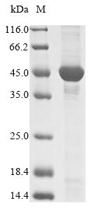 (Tris-Glycine gel) Discontinuous SDS-PAGE (reduced) with 5% enrichment gel and 15% separation gel.