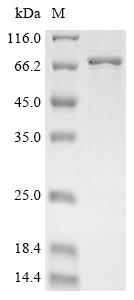 (Tris-Glycine gel) Discontinuous SDS-PAGE (reduced) with 5% enrichment gel and 15% separation gel. (Tris-Glycine gel) Discontinuous SDS-PAGE (reduced) with 5% enrichment gel and 15% separation gel.