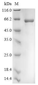 (Tris-Glycine gel) Discontinuous SDS-PAGE (reduced) with 5% enrichment gel and 15% separation gel. (Tris-Glycine gel) Discontinuous SDS-PAGE (reduced) with 5% enrichment gel and 15% separation gel.