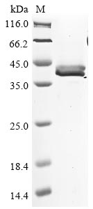 (Tris-Glycine gel) Discontinuous SDS-PAGE (reduced) with 5% enrichment gel and 15% separation gel.