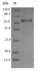 (Tris-Glycine gel) Discontinuous SDS-PAGE (reduced) with 5% enrichment gel and 15% separation gel. (Tris-Glycine gel) Discontinuous SDS-PAGE (reduced) with 5% enrichment gel and 15% separation gel.