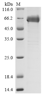 (Tris-Glycine gel) Discontinuous SDS-PAGE (reduced) with 5% enrichment gel and 15% separation gel. (Tris-Glycine gel) Discontinuous SDS-PAGE (reduced) with 5% enrichment gel and 15% separation gel.