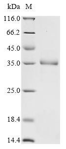 (Tris-Glycine gel) Discontinuous SDS-PAGE (reduced) with 5% enrichment gel and 15% separation gel. (Tris-Glycine gel) Discontinuous SDS-PAGE (reduced) with 5% enrichment gel and 15% separation gel.