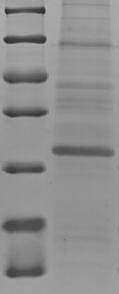 (Tris-Glycine gel) Discontinuous SDS-PAGE (reduced) with 5% enrichment gel and 15% separation gel. (Tris-Glycine gel) Discontinuous SDS-PAGE (reduced) with 5% enrichment gel and 15% separation gel.