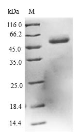 (Tris-Glycine gel) Discontinuous SDS-PAGE (reduced) with 5% enrichment gel and 15% separation gel. (Tris-Glycine gel) Discontinuous SDS-PAGE (reduced) with 5% enrichment gel and 15% separation gel.