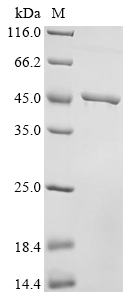 (Tris-Glycine gel) Discontinuous SDS-PAGE (reduced) with 5% enrichment gel and 15% separation gel. (Tris-Glycine gel) Discontinuous SDS-PAGE (reduced) with 5% enrichment gel and 15% separation gel.