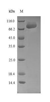 (Tris-Glycine gel) Discontinuous SDS-PAGE (reduced) with 5% enrichment gel and 15% separation gel. (Tris-Glycine gel) Discontinuous SDS-PAGE (reduced) with 5% enrichment gel and 15% separation gel.