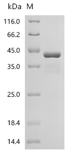(Tris-Glycine gel) Discontinuous SDS-PAGE (reduced) with 5% enrichment gel and 15% separation gel.