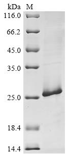 (Tris-Glycine gel) Discontinuous SDS-PAGE (reduced) with 5% enrichment gel and 15% separation gel.
